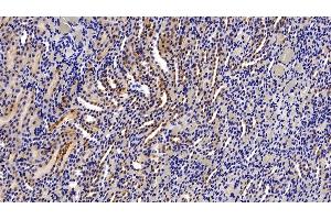 Detection of ASS1 in Rat Kidney Tissue using Polyclonal Antibody to Argininosuccinate Synthetase 1 (ASS1) (ASS1 Antikörper  (AA 1-412))