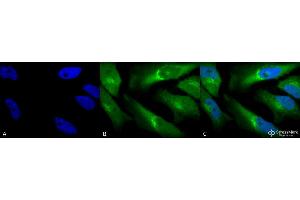 Immunocytochemistry/Immunofluorescence analysis using Rabbit Anti-BVR Polyclonal Antibody . (Biliverdin Reductase Antikörper  (HRP))