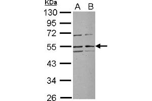 Western Blotting (WB) image for anti-Ribosomal RNA Processing 1 Homolog A (RRP1) (Internal Region) antibody (ABIN1496142) (RRP1 Antikörper  (Internal Region))