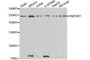 Western blot analysis of extracts of various cell lines, using SMCHD1 antibody. (SMCHD1 Antikörper)