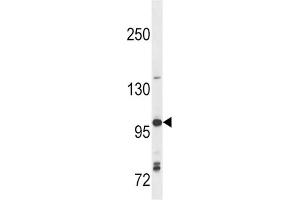 Western Blotting (WB) image for anti-Toll-Like Receptor 7 (TLR7) antibody (ABIN2998417) (TLR7 Antikörper)