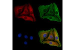 ABIN6258178 and ABIN6273873 staining Hela cells by IF/ICC.