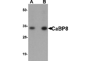 Western blot analysis of CaBP8 in 3T3 cell lysate with CaBP8 antibody at (A) 1 and (B) 2 µg/mL.