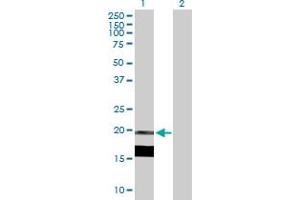 Western Blot analysis of IL7 expression in transfected 293T cell line by IL7 MaxPab polyclonal antibody. (IL-7 Antikörper  (AA 1-177))