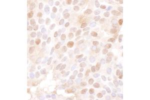 Immunohistochemistry (IHC) image for anti-Minichromosome Maintenance Deficient 4 (MCM4) (AA 325-375) antibody (ABIN7449391)