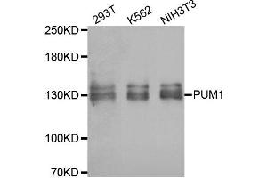 Western blot analysis of extracts of various cell lines, using PUM1 antibody. (PUM1 Antikörper)