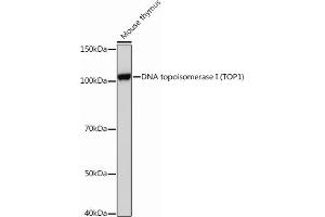 Western blot analysis of extracts of Mouse thymus, using DNA topoisomerase I (DNA topoisomerase I (TOP1)) Rabbit mAb (ABIN7270850) at 1:1000 dilution. (Topoisomerase I Antikörper)