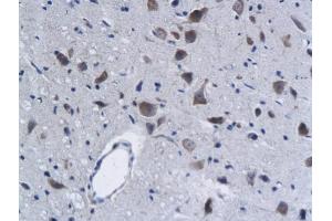 Formalin-fixed and paraffin embedded rat brain labeled with Anti-Phospho-Lyn (Tyr396) Polyclonal Antibody, Unconjugated (ABIN743618) followed by conjugation to the secondary antibody and DAB staining (LYN Antikörper  (pTyr397))