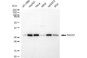 anti-Coiled-Coil Domain Containing 44 (CCDC44) antibody