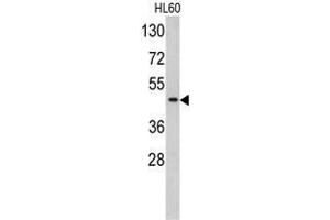 Western blot analysis of TBP antibody (C-term) in HL60 cell line lysates (35ug/lane). (TBP Antikörper  (C-Term))