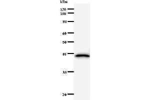 Western Blotting (WB) image for anti-Ras Homolog Gene Family, Member B (RHOB) antibody (ABIN931074)