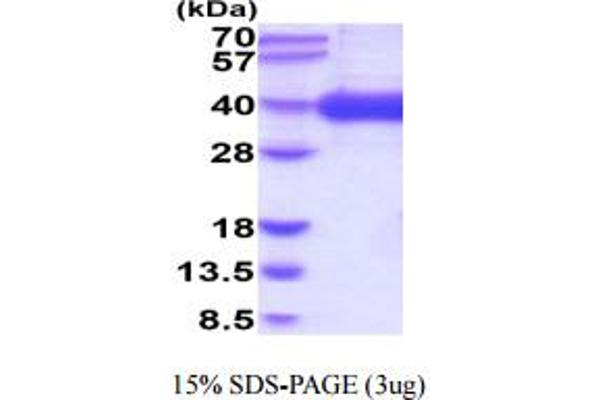 CD1a Protein (CD1a) (AA 19-300) (His tag)