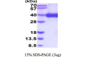 SDS-PAGE (SDS) image for CD1a (CD1a) (AA 19-300) protein (His tag) (ABIN6388036) (CD1a Protein (CD1a) (AA 19-300) (His tag))