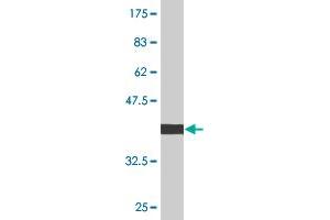 Western Blot detection against Immunogen (36. (CDKN1B Antikörper  (AA 100-198))