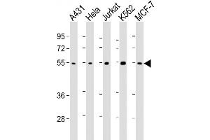 Lane 1: A431, Lane 2: HeLa, Lane 3: Jurkat, Lane 4: K562, Lane 5: MCF-7 cell lysates at 20ug per lane, probed with bsm-51266M CHK1 (2G1D5) Monoclonal Antibody at 1:1000 overnight at 4°C followed by a conjugated secondary antibody for 60 minutes at 37°C. (CHEK1 Antikörper)