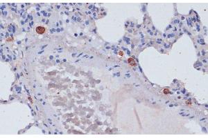 Immunohistochemistry of paraffin-embedded Rat lung using Perforin Polyclonal Antibody at dilution of 1:100 (40x lens). (Perforin 1 Antikörper)