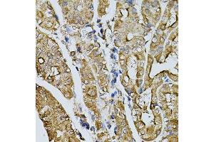 Immunohistochemistry of paraffin-embedded human stomach using MYL1 antibody. (MYL1 Antikörper  (AA 1-150))