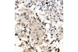 IHC analysis of MNT using anti-MNT antibody (ABIN7601555).
