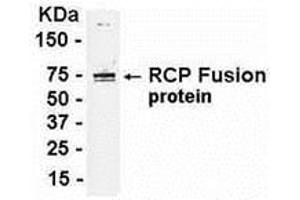 Western Blotting (WB) image for anti-Rab11 Family-Interacting Protein 1 (RAB11FIP1) (AA 265-465) antibody (ABIN2468019)