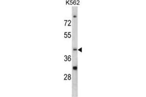 Western Blotting (WB) image for anti-CCR4 Carbon Catabolite Repression 4-Like (CCRN4L) antibody (ABIN3002711) (CCRN4L Antikörper)