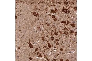 Immunohistochemical staining of human hippocampus with KARS polyclonal antibody  shows strong cytoplasmic positivity in neuronal cells at 1:500-1:1000 dilution. (KARS Antikörper)