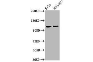 Western Blot Positive WB detected in: Hela whole cell lysate, NIH/3T3 whole cell lysate All lanes: MKL2 antibody at 4. (MKL2 Antikörper  (AA 164-313))