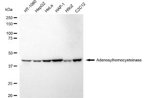 Western blotting analysis using Adenosylhomocysteinase antibody (ABIN7797518).