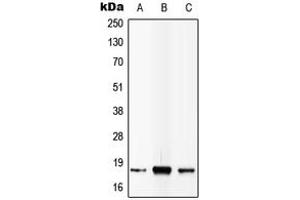 Western blot analysis of IL-4 expression in MCF7 (A), SP2/0 (B), PC12 (C) whole cell lysates. (IL-4 Antikörper  (C-Term))