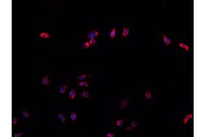 ABIN6266561 staining U-2 OS cells by IF/ICC. (HDAC9 Antikörper  (C-Term))