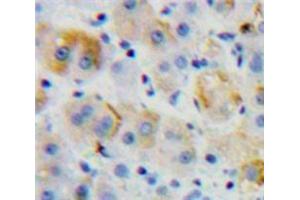 IHC-P analysis of Liver tissue, with DAB staining. (CD97 Antikörper  (AA 32-173))