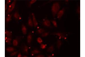 Immunofluorescence (IF) image for anti-Propionyl CoA Carboxylase beta Polypeptide (PCCB) antibody (ABIN1876603) (PCCB Antikörper)