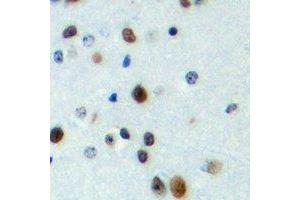 Immunohistochemical analysis of FOXN4 staining in human brain formalin fixed paraffin embedded tissue section. (FOXN4 Antikörper  (C-Term))