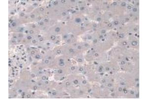 IHC-P analysis of Mouse Liver Tissue, with DAB staining. (Cortactin Antikörper  (AA 1-509))
