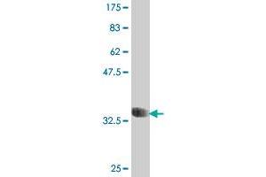 Western Blot detection against Immunogen (35. (CCL15 Antikörper  (AA 25-113))