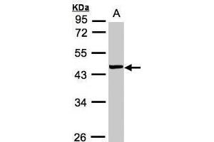 WB Image Sample(30 ug whole cell lysate) A:MOLT4 , 10% SDS PAGE antibody diluted at 1:1000 (VPS72 Antikörper)