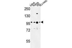 Western blot analysis of BCL11A Antibody (C-term) in Jurkat, Ramos, 293, NCI-H460 cell line lysates (35µg/lane). (BCL11A Antikörper  (C-Term))
