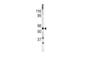 The anti-Phospho-CDC25A- Pab (ABIN389529 and ABIN2839577) is used in Western blot to detect Phospho-CDC25A- in mouse heart tissue lysate (CDC25A Antikörper  (pSer278))