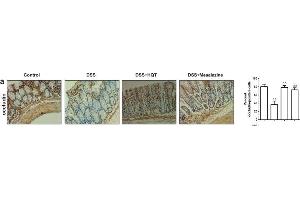 HQT regulates epithelial proliferation in the colonic mucosa of mice with DSS-induced acute and chronic colitis. (Occludin Antikörper  (AA 431-522))