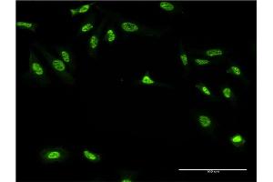 Immunofluorescence of monoclonal antibody to GAN on HeLa cell.