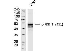 Mouse liver lysates probed with PKR(Thr451) Polyclonal Antibody, unconjugated  at 1:300 overnight at 4°C followed by a conjugated secondary antibody at 1:10000 for 90 minutes at 37°C. (EIF2AK2 Antikörper  (pThr451))