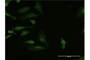 Immunofluorescence of monoclonal antibody to HHEX on HeLa cell. (HHEX Antikörper  (AA 133-237))