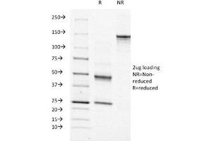 SDS-PAGE Analysis of Purified, BSA-Free Moesin Antibody (clone MSN/491). (Moesin Antikörper)