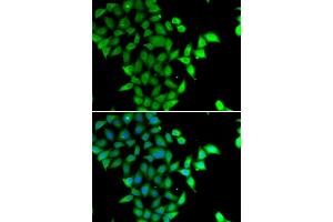 Immunofluorescence analysis of U2OS cells using STAM2 antibody (ABIN5974246). (STAM2 Antikörper)