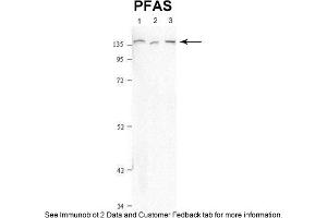 Sample Type: 1. (PFAS Antikörper  (N-Term))