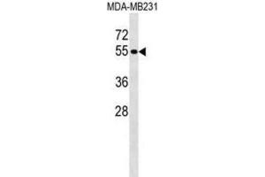 Western Blotting (WB) image for anti-Protein tyrosine Phosphatase, Non-Receptor Type 18 (Brain-Derived) (PTPN18) antibody (ABIN2999086) (PTPN18 Antikörper)