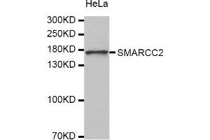 Western Blotting (WB) image for anti-SWI/SNF Related, Matrix Associated, Actin Dependent Regulator of Chromatin, Subfamily C, Member 2 (SMARCC2) antibody (ABIN1874865) (SMARCC2 Antikörper)