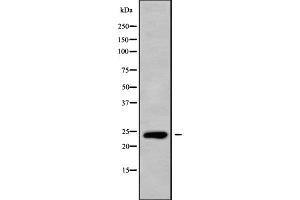 Western blot analysis of CLEC6A using HepG2 whole cell lysates (C-Type Lectin Domain Family 6, Member A (CLEC6A) (Internal Region) Antikörper)