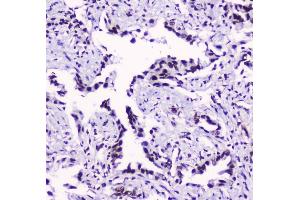 IHC analysis of SMC3 using anti-SMC3 antibody (ABIN5693037). (SMC3 Antikörper  (C-Term))