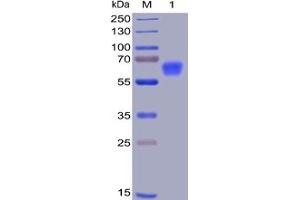 Human CD47, mFc-His Tag on SDS-PAGE under reducing condition. (CD47 Protein (CD47) (mFc-His Tag))