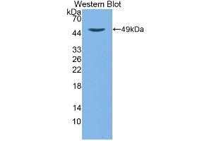 Detection of Recombinant TTPa, Mouse using Polyclonal Antibody to Alpha-Tocopherol Transfer Protein (TTPa) (TTPA Antikörper  (AA 88-253))